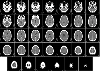CAT Scan images of a human brain by cross-section.